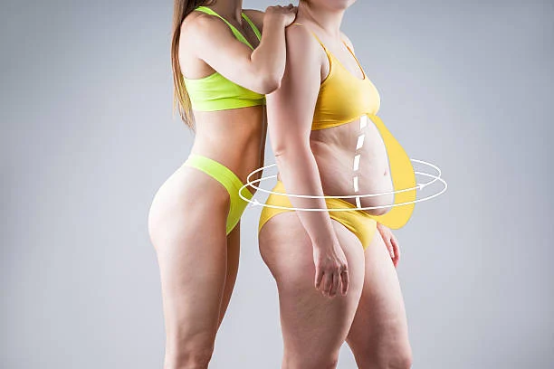 Liposuction and Body Contouring