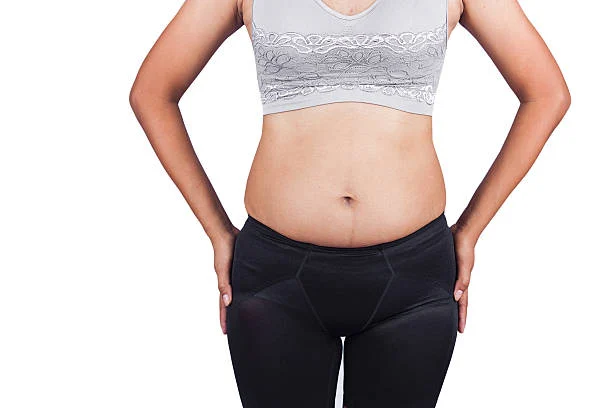 Types of post-weight-loss abdominoplasty