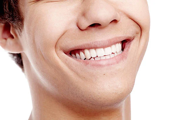 Veneer and its characteristics