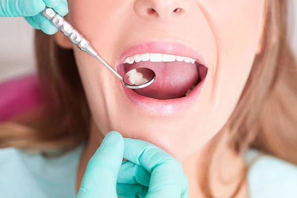 The Difference Between Cosmetic Fillings and Traditional Fillings