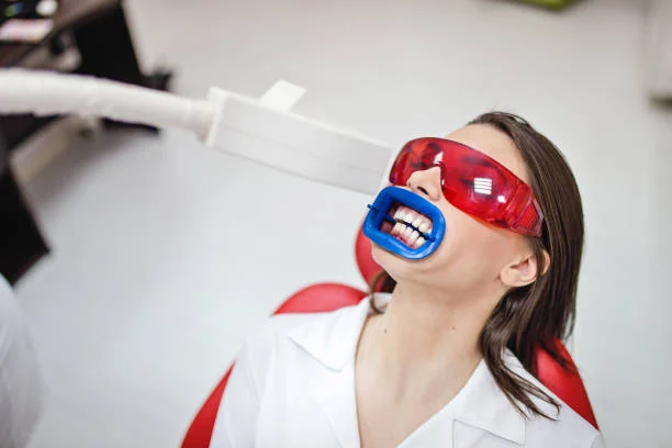 Why laser whitening is so popular