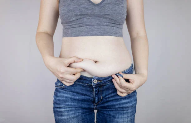 Skin Sagging After Obesity Surgery: When Is Surgery Necessary?