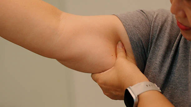 Types of Surgeries Used to Treat Skin Sagging